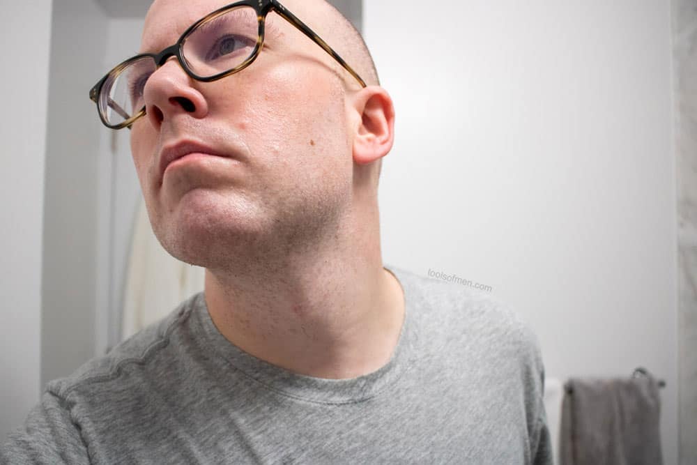 closeup of mans neck after applying balm