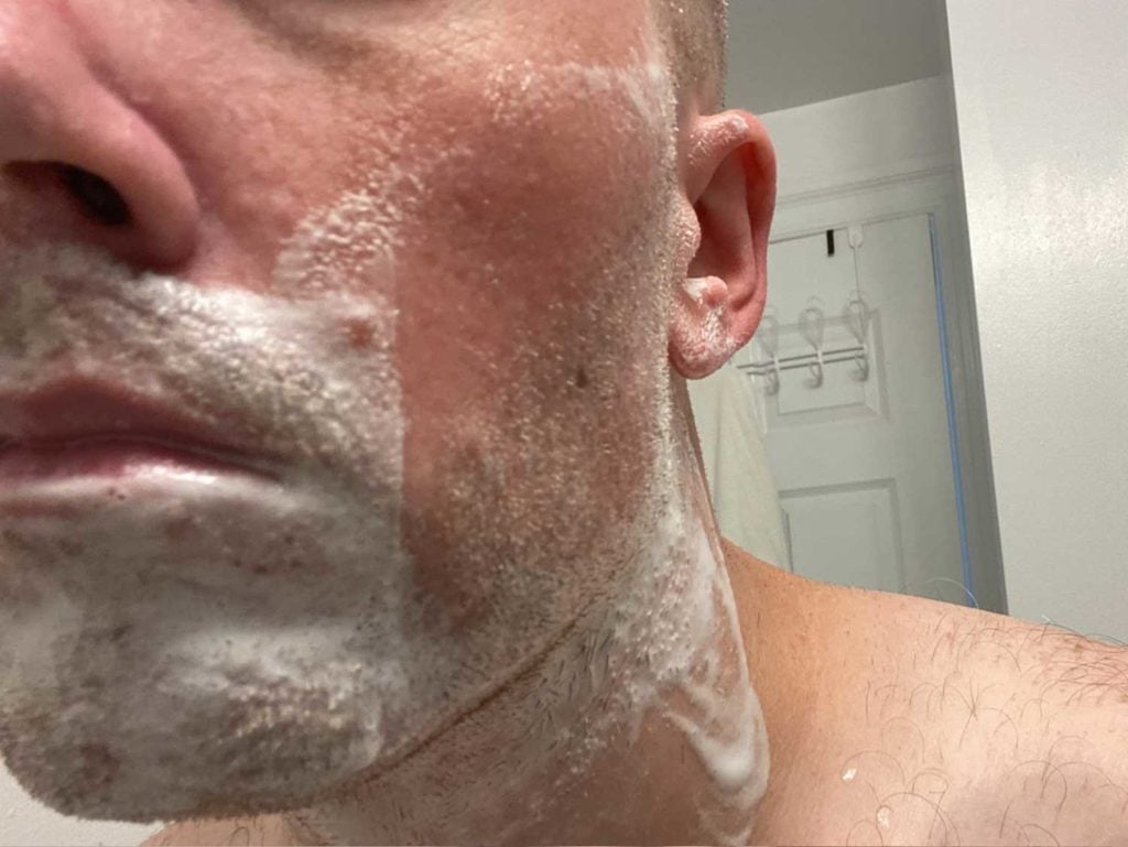 closeup of cheek after a single pass with the oneblade core